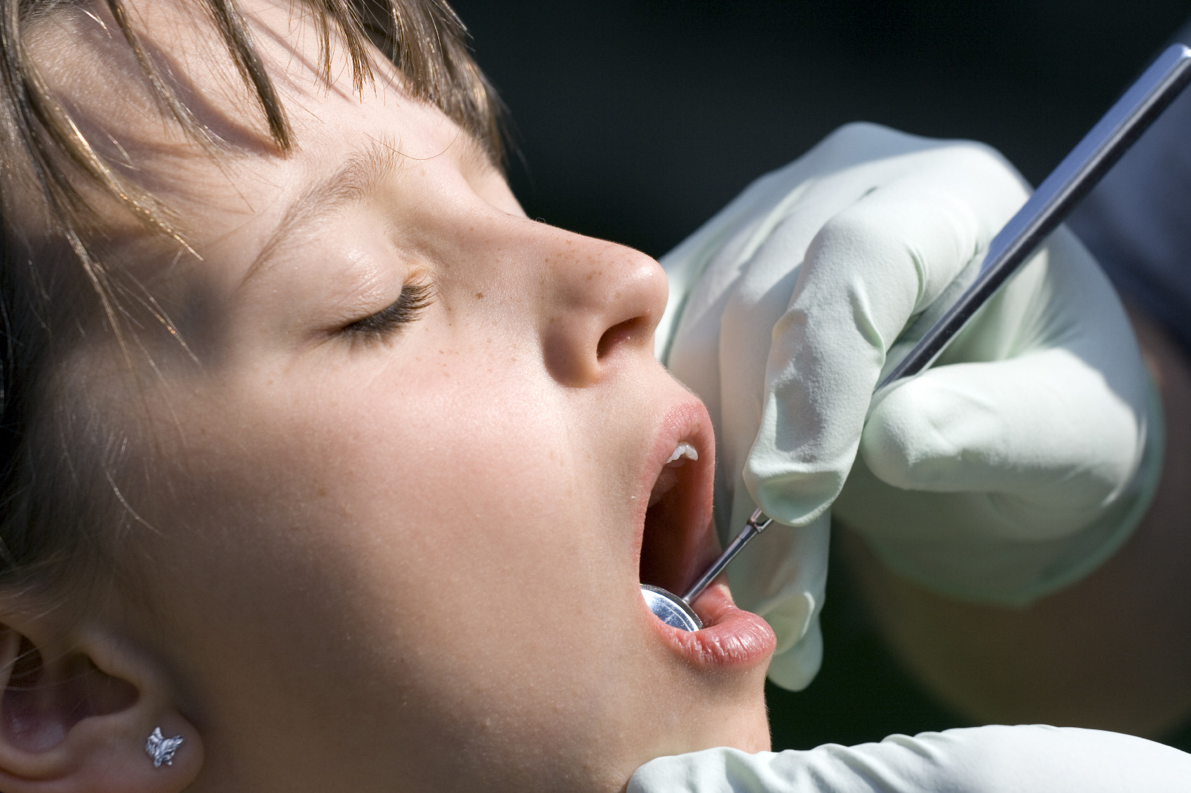 sedation-dentistry-potomac-pediatric-dentistry