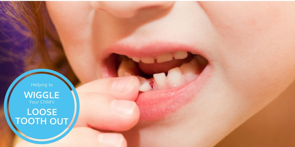 Helping to Wiggle Your Child’s Loose Tooth Out Potomac Pediatric