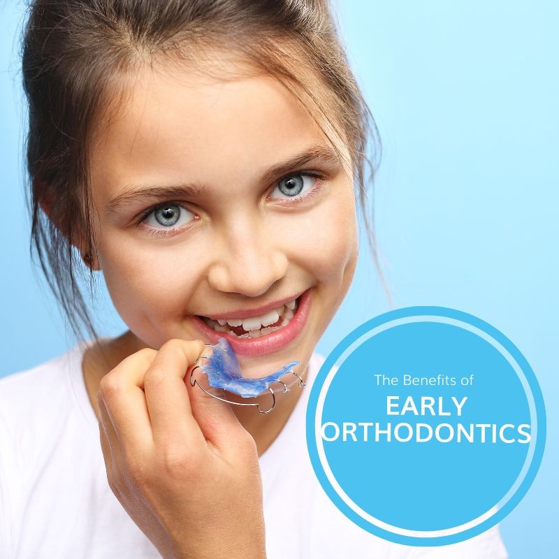 The Benefits of Early Orthodontics | Potomac Pediatric Dentistry