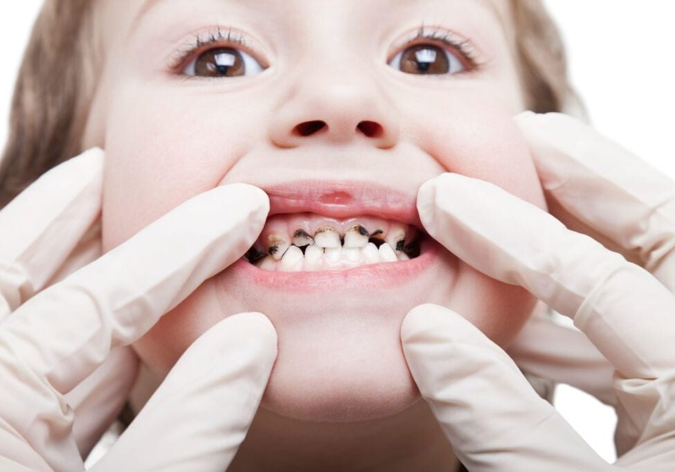 Common Dental Problems | Dumfries Pediatric Dentist | Potomac Pediatric Dentistry